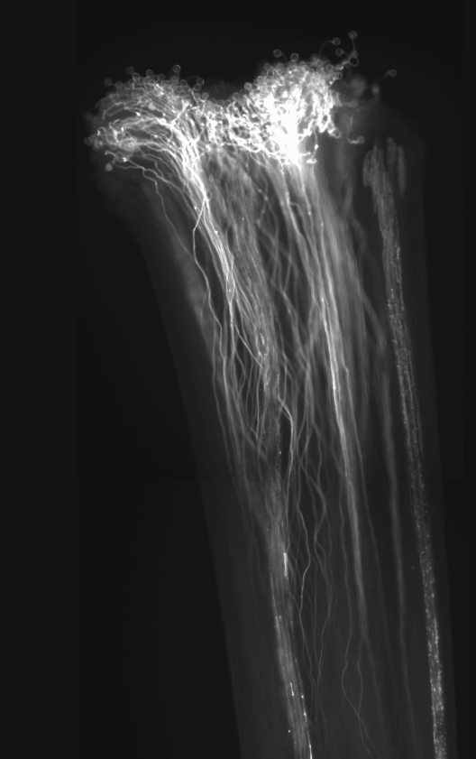 140804_R11_#2_aniline_10X